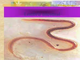 Las lombrices y la impracticabilidad del intestino